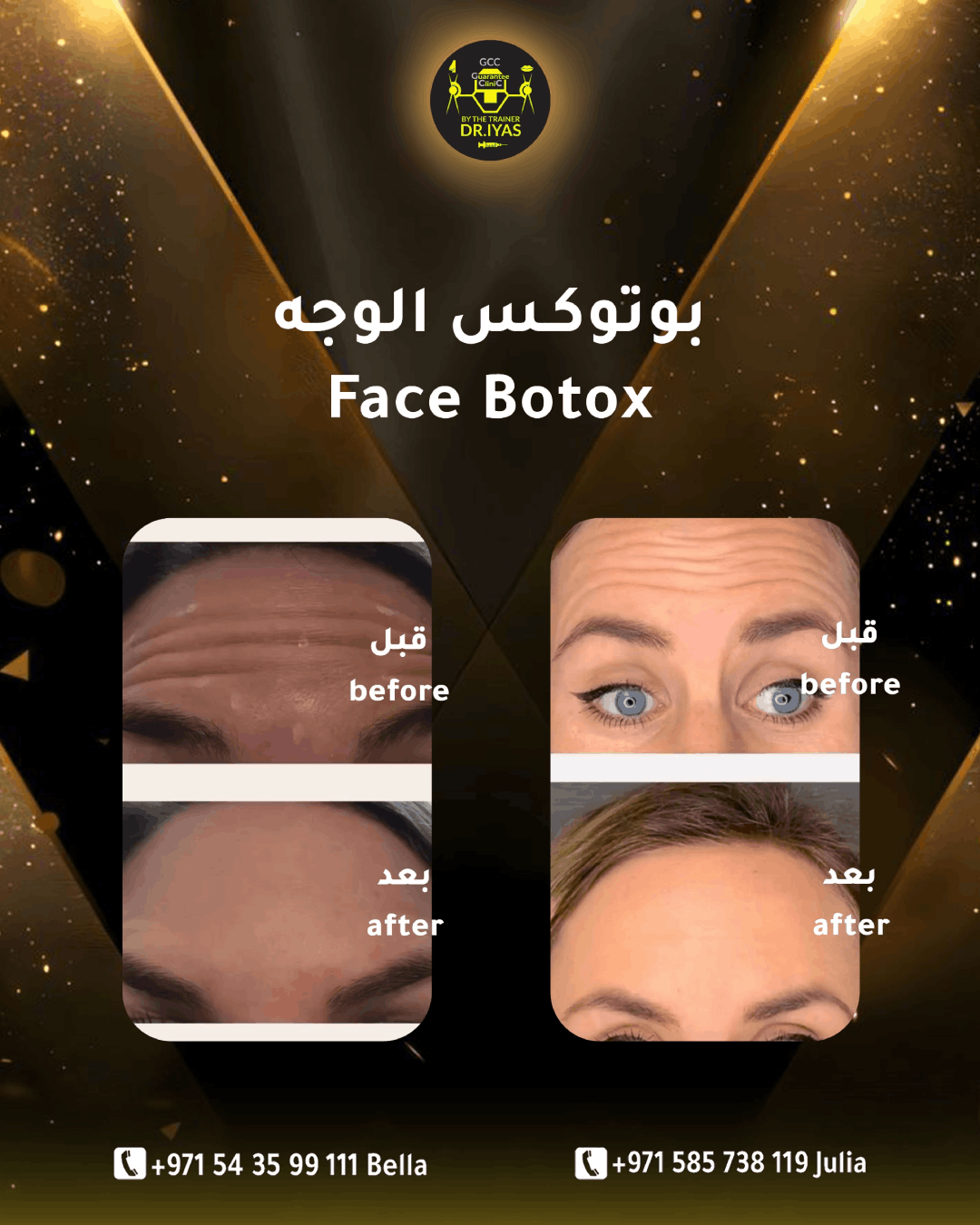 قبل وبعد 2